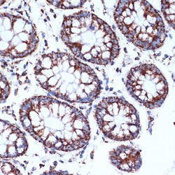 CLPP Recombinant Rabbit Monoclonal Antibody (ARC1929), Invitrogen 100 &mu;L;
