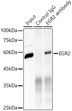 Invitrogen EGR2 Recombinant Rabbit Monoclonal Antibody (1F6V7) 100 &mu;L;