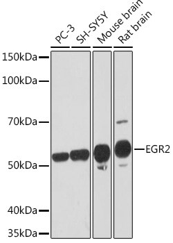 Invitrogen EGR2 Recombinant Rabbit Monoclonal Antibody (1F6V7) 100 &mu;L;