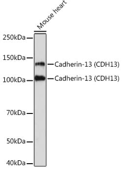 Invitrogen H-cadherin Recombinant Rabbit Monoclonal Antibody (4Z8D1) 100