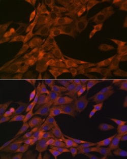 Invitrogen WFDC2 Recombinant Rabbit Monoclonal Antibody (6K2F5) 100 &mu;L;