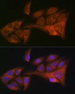 Invitrogen WFDC2 Recombinant Rabbit Monoclonal Antibody (6K2F5) 100 &mu;L;