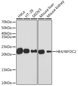 Invitrogen WFDC2 Recombinant Rabbit Monoclonal Antibody (6K2F5) 100 &mu;L;