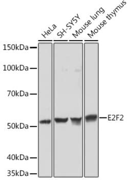 Invitrogen E2F2 Recombinant Rabbit Monoclonal Antibody (1H7D6) 100 &mu;L;
