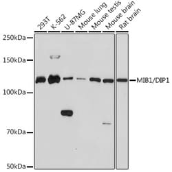 Invitrogen MIB1 Recombinant Rabbit Monoclonal Antibody (9Q4N9) 100 &mu;L;
