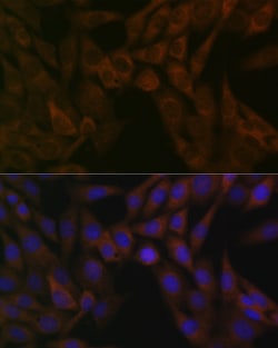Invitrogen ARF5 Recombinant Rabbit Monoclonal Antibody (0U0D2) 100 &mu;L;