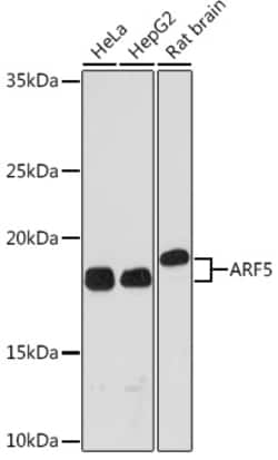 Invitrogen ARF5 Recombinant Rabbit Monoclonal Antibody (0U0D2) 100 &mu;L;
