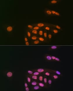 Invitrogen MYST1 Recombinant Rabbit Monoclonal Antibody (6U5Z6) 100 &mu;L;