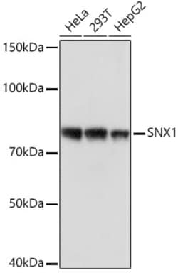 Invitrogen SNX1 Recombinant Rabbit Monoclonal Antibody (8G8Z2) 100 &mu;L;