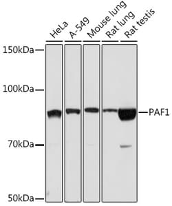 Invitrogen PAF1 Recombinant Rabbit Monoclonal Antibody (3U5C4) 100 &mu;L | Buy Online | Invitrogen&trade; | Fisher Scientific