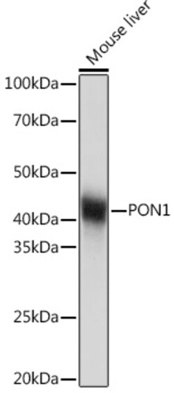 Invitrogen PON1 Recombinant Rabbit Monoclonal Antibody (4X7X2) 100 &mu;L;