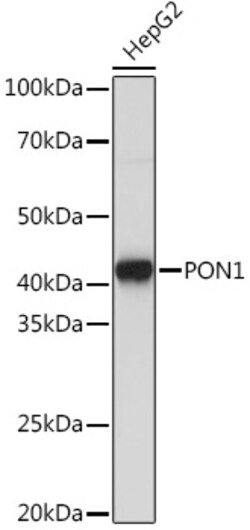 Invitrogen PON1 Recombinant Rabbit Monoclonal Antibody (4X7X2) 100 &mu;L;
