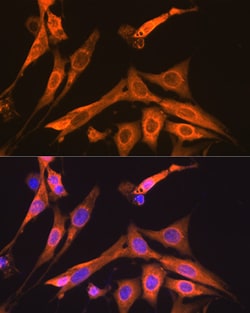 Invitrogen S100A6 Recombinant Rabbit Monoclonal Antibody (0J1Q5) 100 &mu;L;