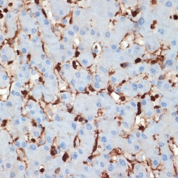 Invitrogen S100A6 Recombinant Rabbit Monoclonal Antibody (0J1Q5) 100 &mu;L;