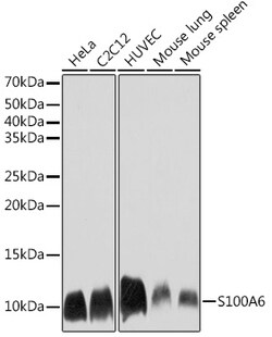 Invitrogen S100A6 Recombinant Rabbit Monoclonal Antibody (0J1Q5) 100 &mu;L;