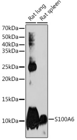 Invitrogen S100A6 Recombinant Rabbit Monoclonal Antibody (0J1Q5) 100 &mu;L;