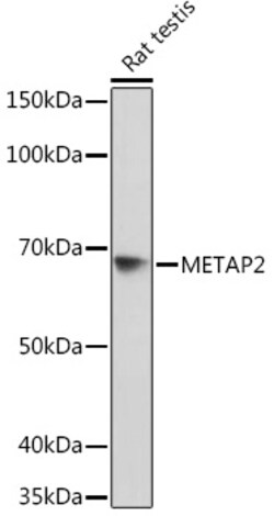 Invitrogen METAP2 Recombinant Rabbit Monoclonal Antibody (5U2F4) 100 &mu;L | Buy Online | Invitrogen&trade; | Fisher Scientific