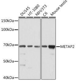 Invitrogen METAP2 Recombinant Rabbit Monoclonal Antibody (5U2F4) 100 &mu;L | Buy Online | Invitrogen&trade; | Fisher Scientific