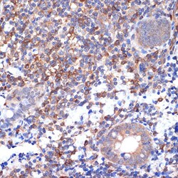 Invitrogen VAV2 Recombinant Rabbit Monoclonal Antibody (3S0O9) 100 &mu;L;