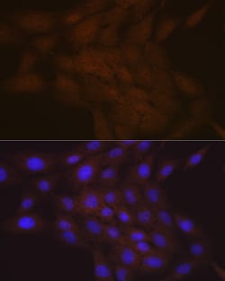 Invitrogen SMC4 Recombinant Rabbit Monoclonal Antibody (9Z8S3) 100 &mu;L;