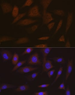 Invitrogen SMC4 Recombinant Rabbit Monoclonal Antibody (9Z8S3) 100 &mu;L;