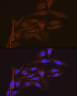 Invitrogen SMC4 Recombinant Rabbit Monoclonal Antibody (9Z8S3) 100 &mu;L;