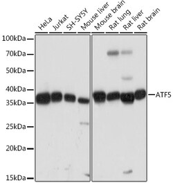 Invitrogen ATF5 Recombinant Rabbit Monoclonal Antibody (9Z3M0) 100 &mu;L;