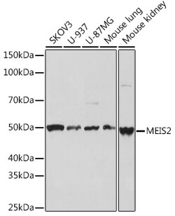 Invitrogen MEIS2 Recombinant Rabbit Monoclonal Antibody (2A6I3) 100 &mu;L;