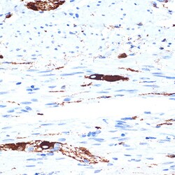 Invitrogen alpha Internexin Recombinant Rabbit Monoclonal Antibody (5E5Z3)