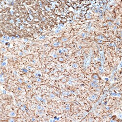 Invitrogen alpha Internexin Recombinant Rabbit Monoclonal Antibody (5E5Z3)
