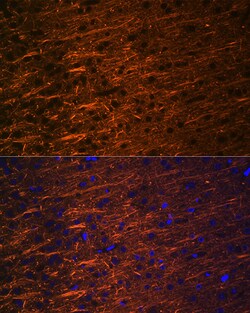 Invitrogen alpha Internexin Recombinant Rabbit Monoclonal Antibody (5E5Z3)