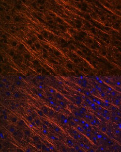Invitrogen alpha Internexin Recombinant Rabbit Monoclonal Antibody (5E5Z3)