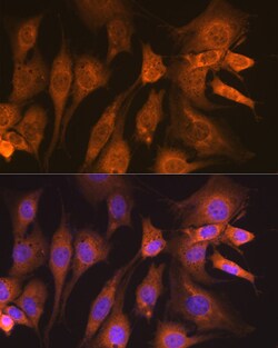 Invitrogen GUCY1B3 Recombinant Rabbit Monoclonal Antibody (5O8D9) 100 &mu;L;
