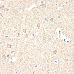 Invitrogen GUCY1B3 Recombinant Rabbit Monoclonal Antibody (5O8D9) 100 &mu;L;
