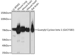 Invitrogen GUCY1B3 Recombinant Rabbit Monoclonal Antibody (5O8D9) 100 &mu;L;