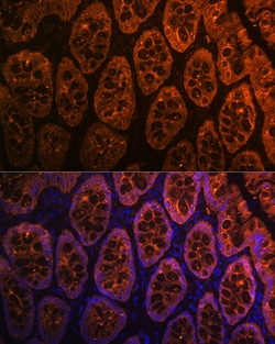 Invitrogen Galectin 4 Recombinant Rabbit Monoclonal Antibody (9Z2B5) 100