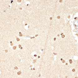 Invitrogen Histone H2A Recombinant Rabbit Monoclonal Antibody (1P5B6) 100