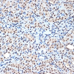 Invitrogen Histone H2A Recombinant Rabbit Monoclonal Antibody (1P5B6) 100