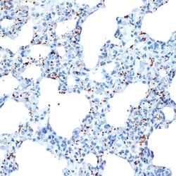 Invitrogen PF4 Recombinant Rabbit Monoclonal Antibody (6Q10H2) 100 &mu;L | Buy Online | Invitrogen&trade; | Fisher Scientific