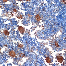 Invitrogen PF4 Recombinant Rabbit Monoclonal Antibody (6Q10H2) 100 &mu;L | Buy Online | Invitrogen&trade; | Fisher Scientific