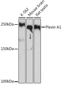 Invitrogen Plexin-A1 Recombinant Rabbit Monoclonal Antibody (2A5Z6) 100 &mu;L | Buy Online | Invitrogen&trade; | Fisher Scientific