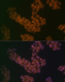 BANF1 Recombinant Rabbit Monoclonal Antibody (6J8O2):Antibodies, Recombinant