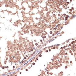 BANF1 Recombinant Rabbit Monoclonal Antibody (6J8O2):Antibodies, Recombinant