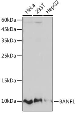 BANF1 Recombinant Rabbit Monoclonal Antibody (6J8O2):Antibodies, Recombinant