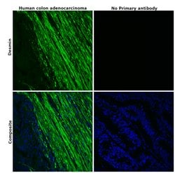 Invitrogen Desmin Recombinant Rabbit Monoclonal Antibody (6O9O4) 100 &mu;L;