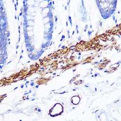 Invitrogen Desmin Recombinant Rabbit Monoclonal Antibody (6O9O4) 100 &mu;L;