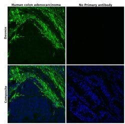 Invitrogen Desmin Recombinant Rabbit Monoclonal Antibody (6O9O4) 100 &mu;L;
