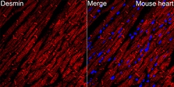 Invitrogen Desmin Recombinant Rabbit Monoclonal Antibody (6O9O4) 100 &mu;L;