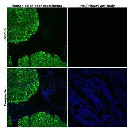 Invitrogen Desmin Recombinant Rabbit Monoclonal Antibody (6O9O4) 100 &mu;L;
