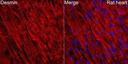 Invitrogen Desmin Recombinant Rabbit Monoclonal Antibody (6O9O4) 100 &mu;L;